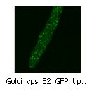 Golgi_vps_52_GFP_tip