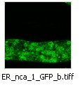 ER_nca_1_GFP_b