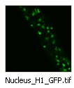 Nucleus_tip_H1_GFP
