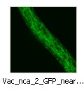 Vac_nca_2_GFP_near_tip
