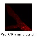 Vac_RFP_vma_1_tips