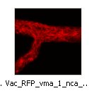 Vac_RFP_vma_1_nca_2_GFPa
